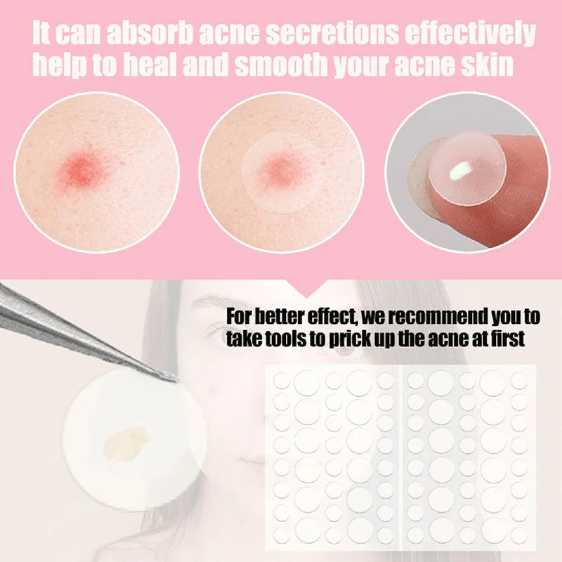Face and Body Pimple Patches for Covering Pimples