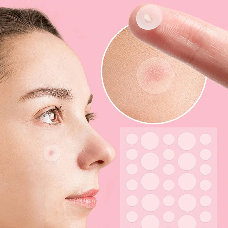 Face and Body Pimple Patches for Covering Pimples