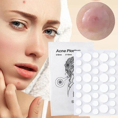 Face and Body Pimple Patches for Covering Pimples